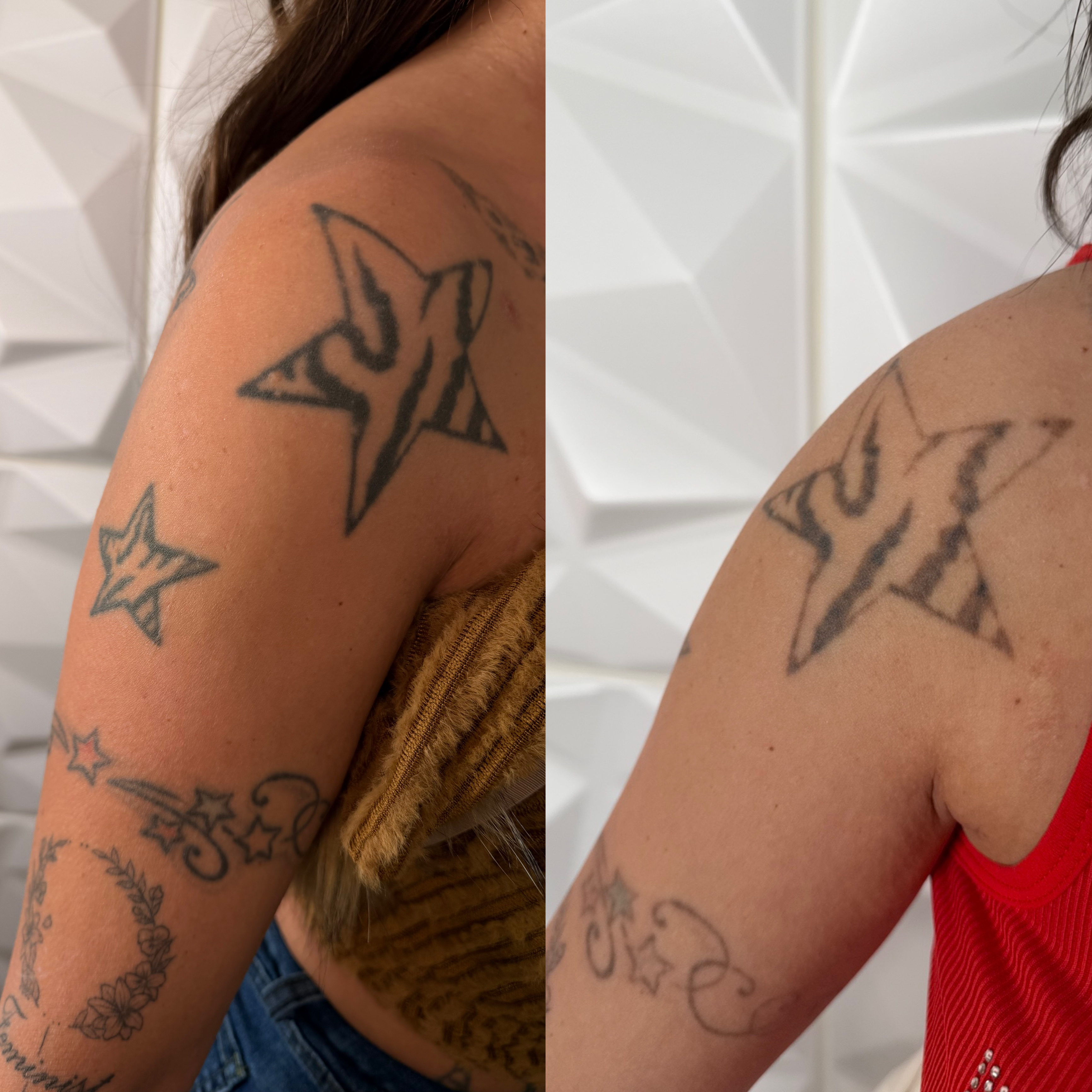 Bestes Ergebnis — Vorher/Nachher